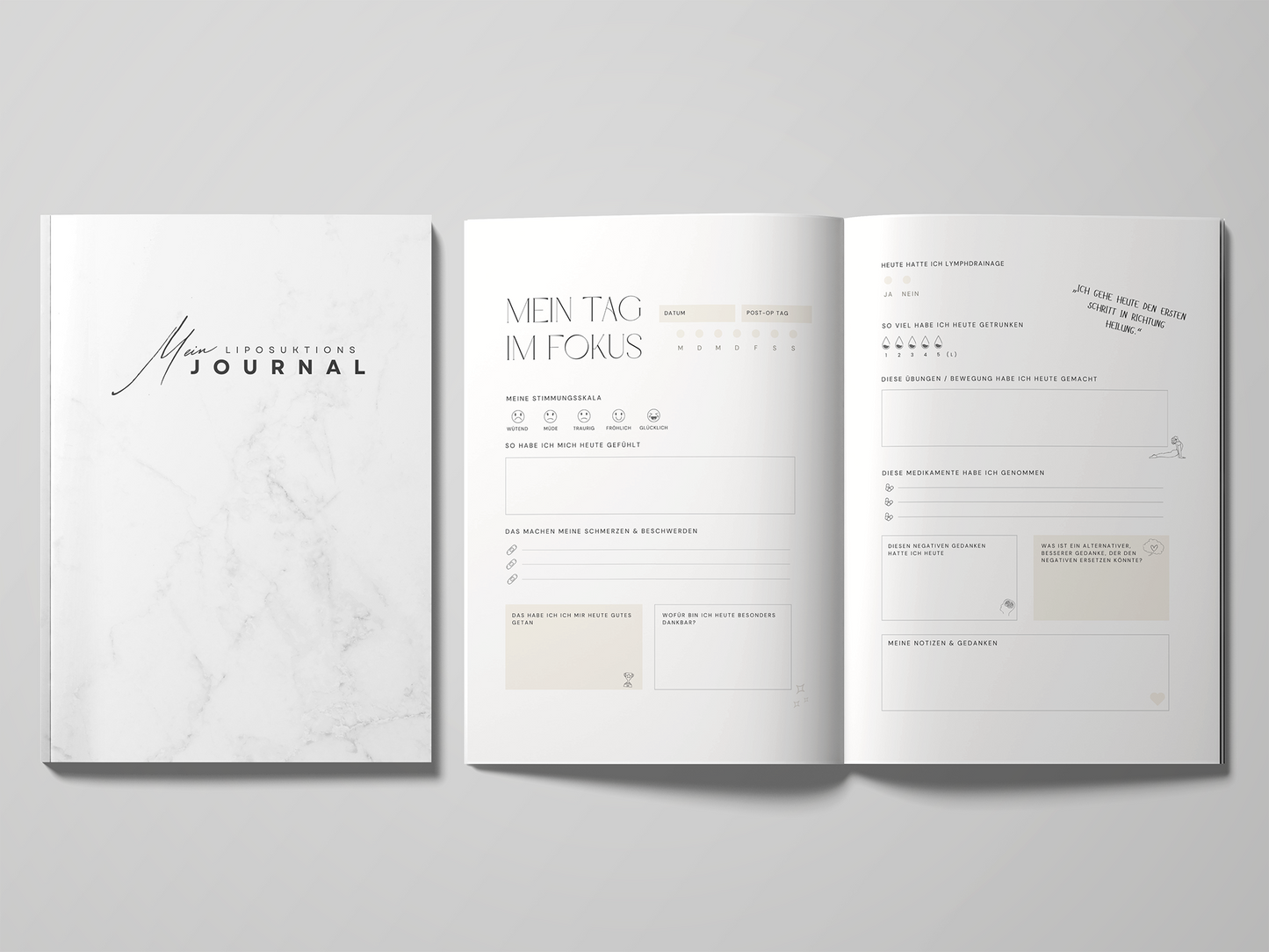 Liposuktions Journal | Dein Tagebuch für die Lipödem-OP